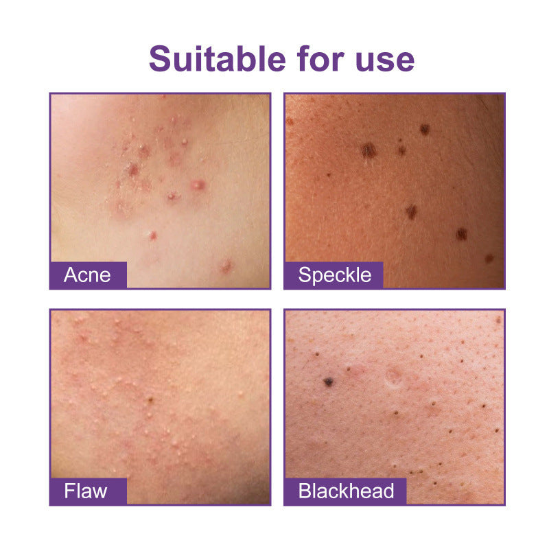 Acne Patch- Waterproof, Breathable